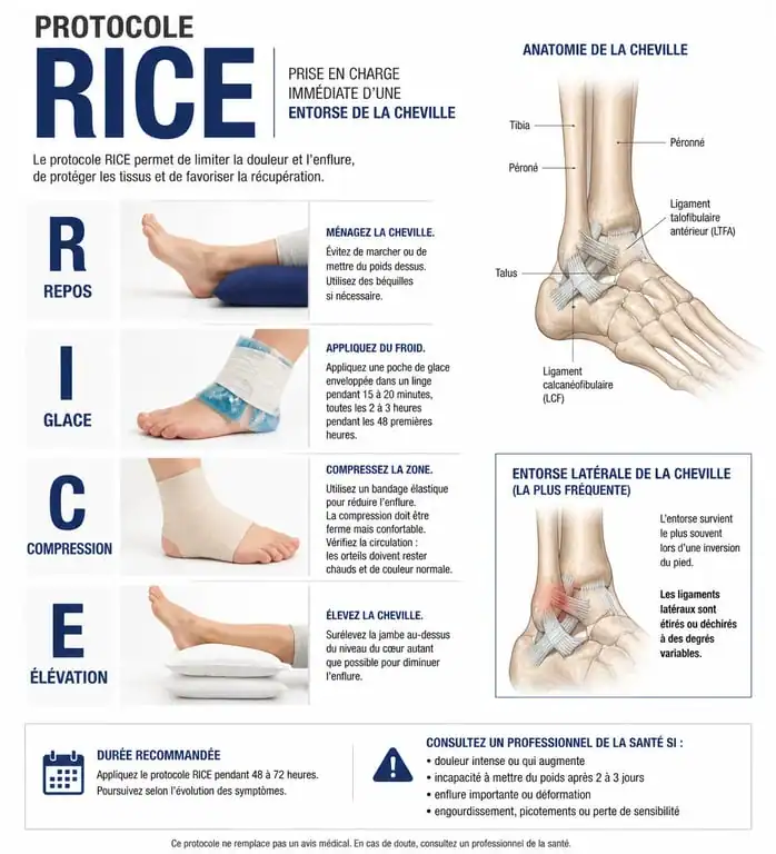 Infographie du protocole RICE pour le traitement d'une entorse à la cheville